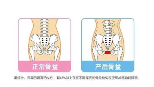 产后后遗症有哪些表现？七大常见后遗症，你中了几个？